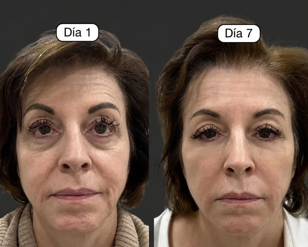 Cepillo Facial Para Masajes de Drenaje Linfático